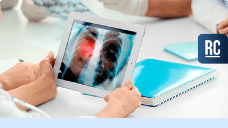 Ensaio de um inibidor preferencial da fosfodiesterase 4B para fibrose pulmonar idiopática