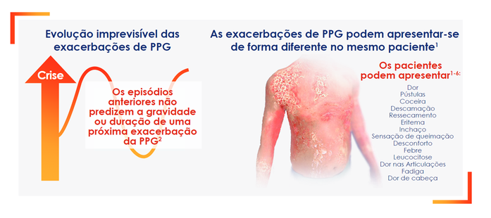 Impacto da crise de PPG 