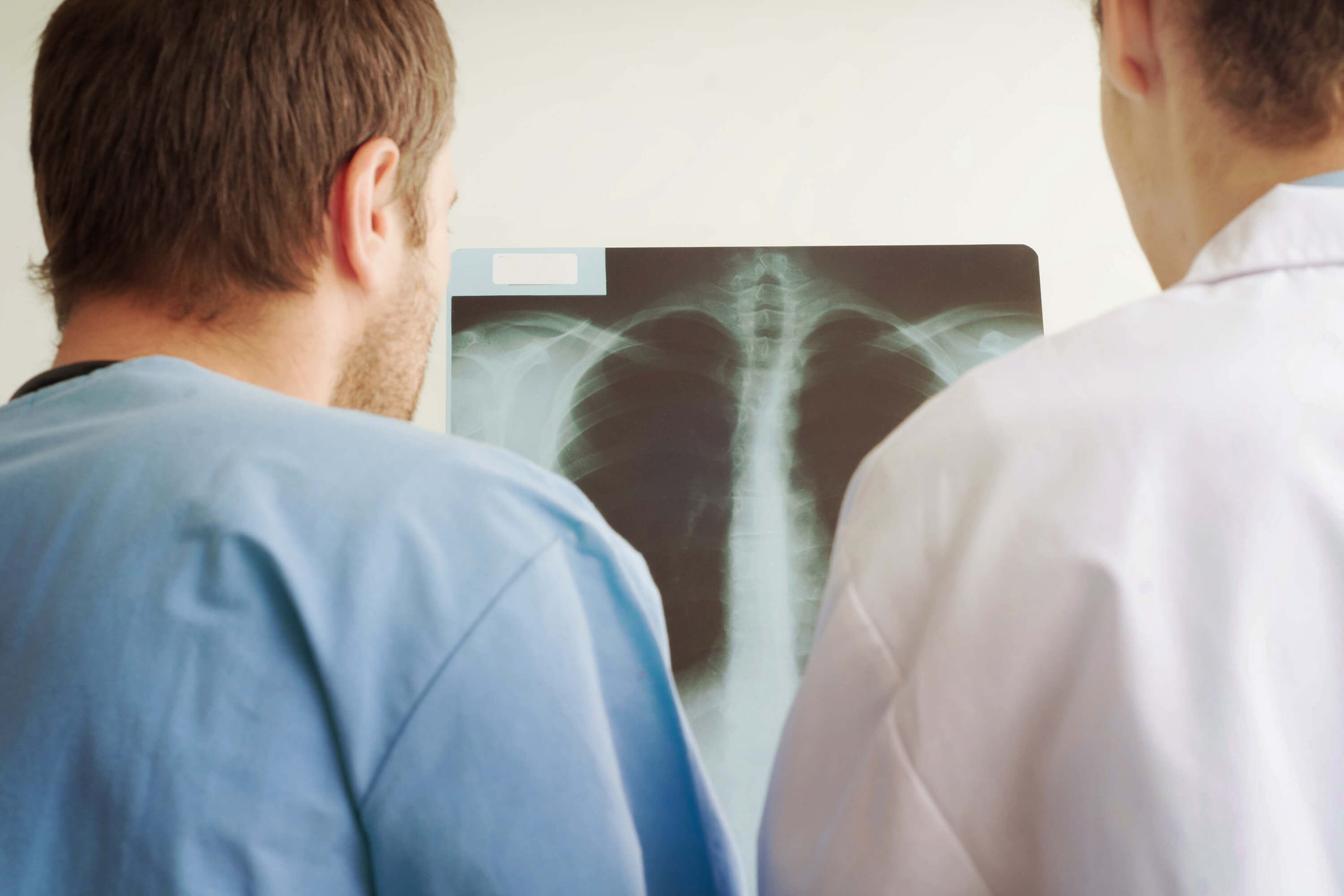 Preferências do paciente para o tratamento da doença pulmonar intersticial associada à esclerose sistêmica um experimento de escolha discreta 