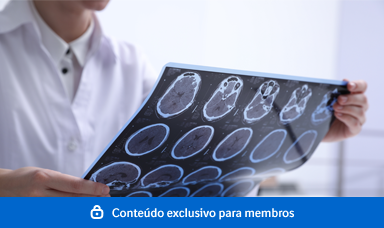 Esclerose Sistêmica 