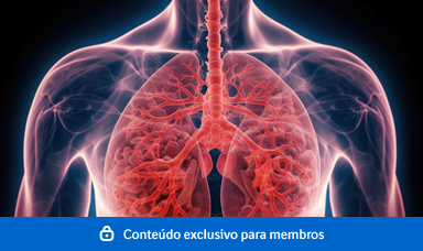 Fibrose Pulmonar Idiopática