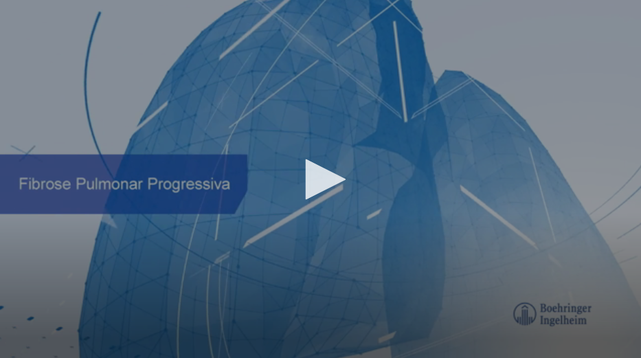 Aula 9 - Fibrose Pulmonar Progressiva - Dra. Fernanda Baptista