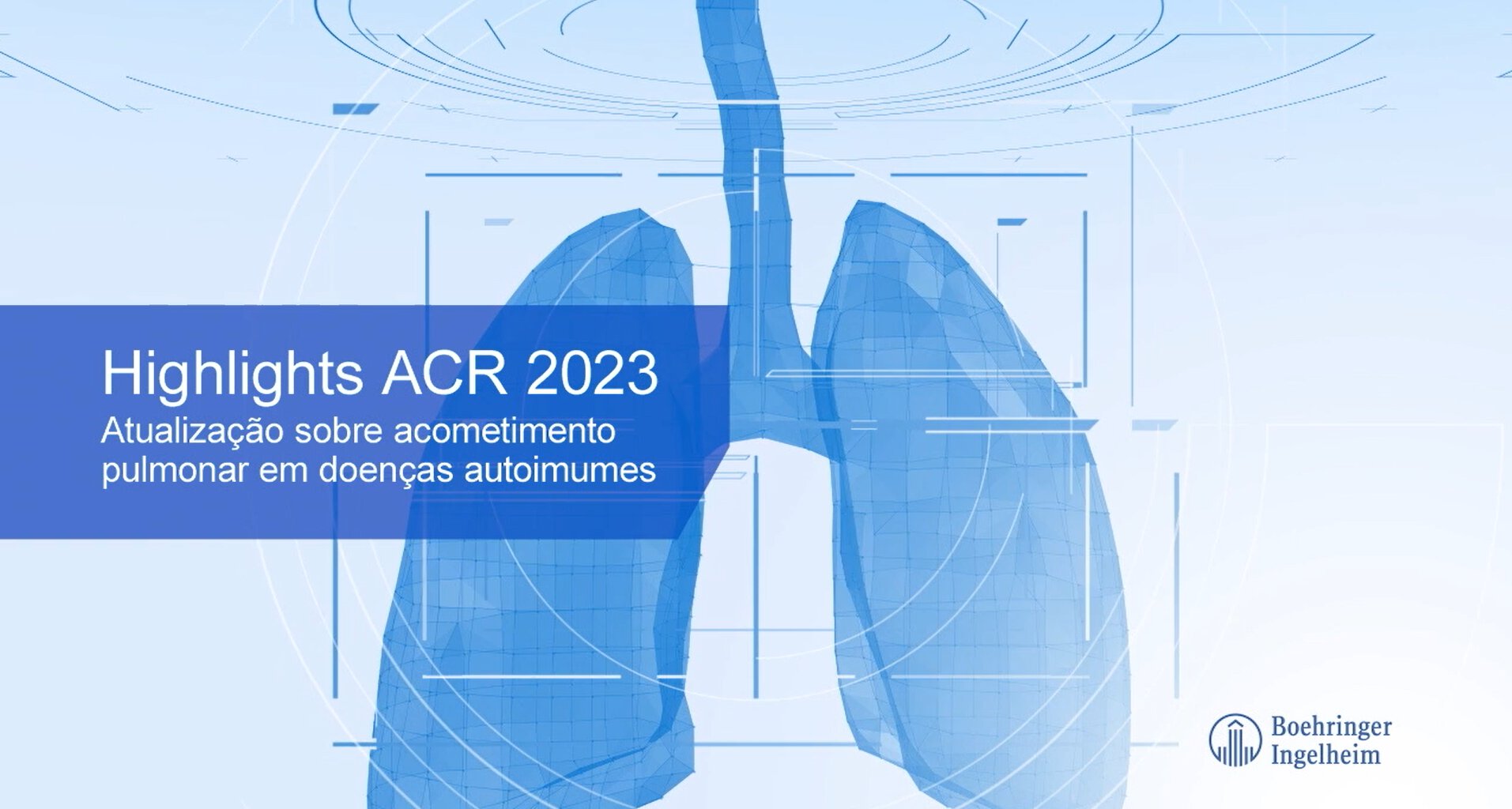 Aula 13 - Highlights ACR 2023: Atualizações sobre acometimento pulmonar em doenças autoimunes