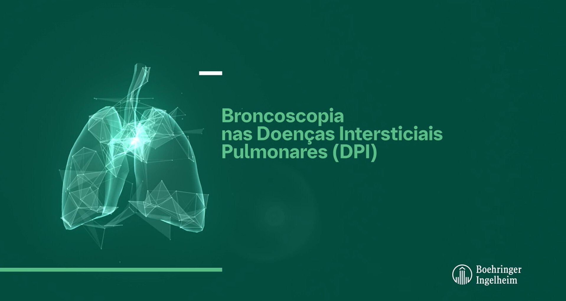 Aula 14 - Broncoscopia nas Doenças Intersticiais Pulmonares - Dr. Luis Renato Alves