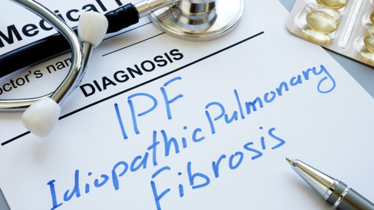 HIGHLIGHTS ERS | Alterações na função pulmonar e risco de mortalidade em pacientes com fibrose pulmonar intersticial