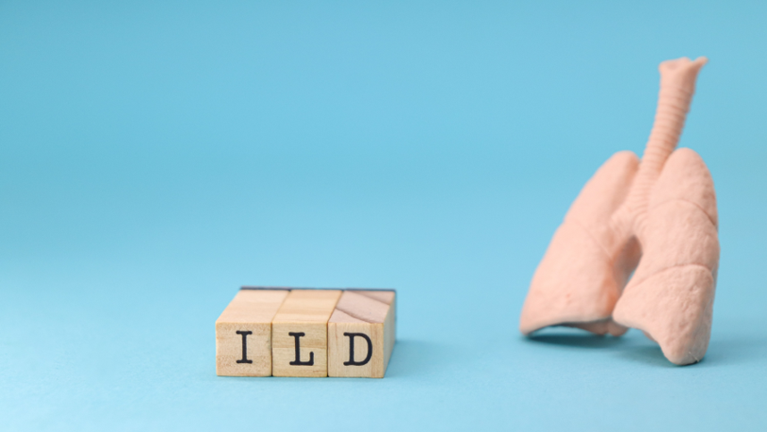 HIGHLIGHTS ERS | Características demográficas dos pacientes randomizados no estudo de nerandomilaste FIBRONEER TM-ILD