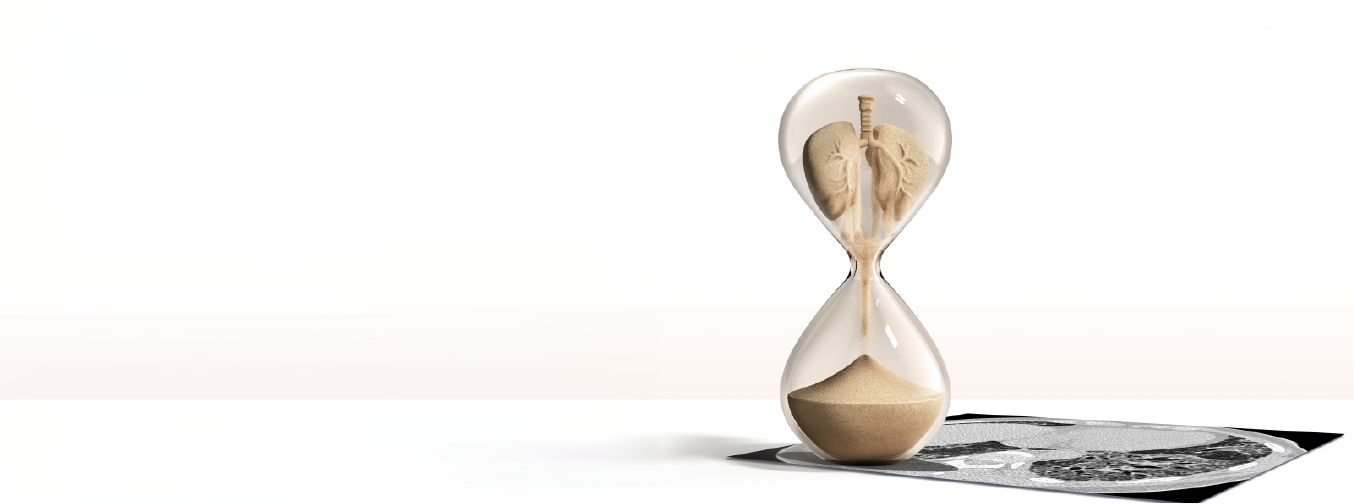 SUSPEITE DA FIBROSE PULMONAR (FP)!