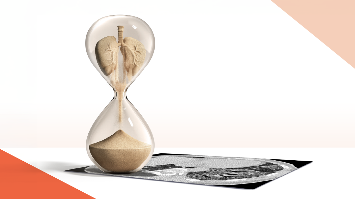 Suspeite de Fibrose Pulmonar