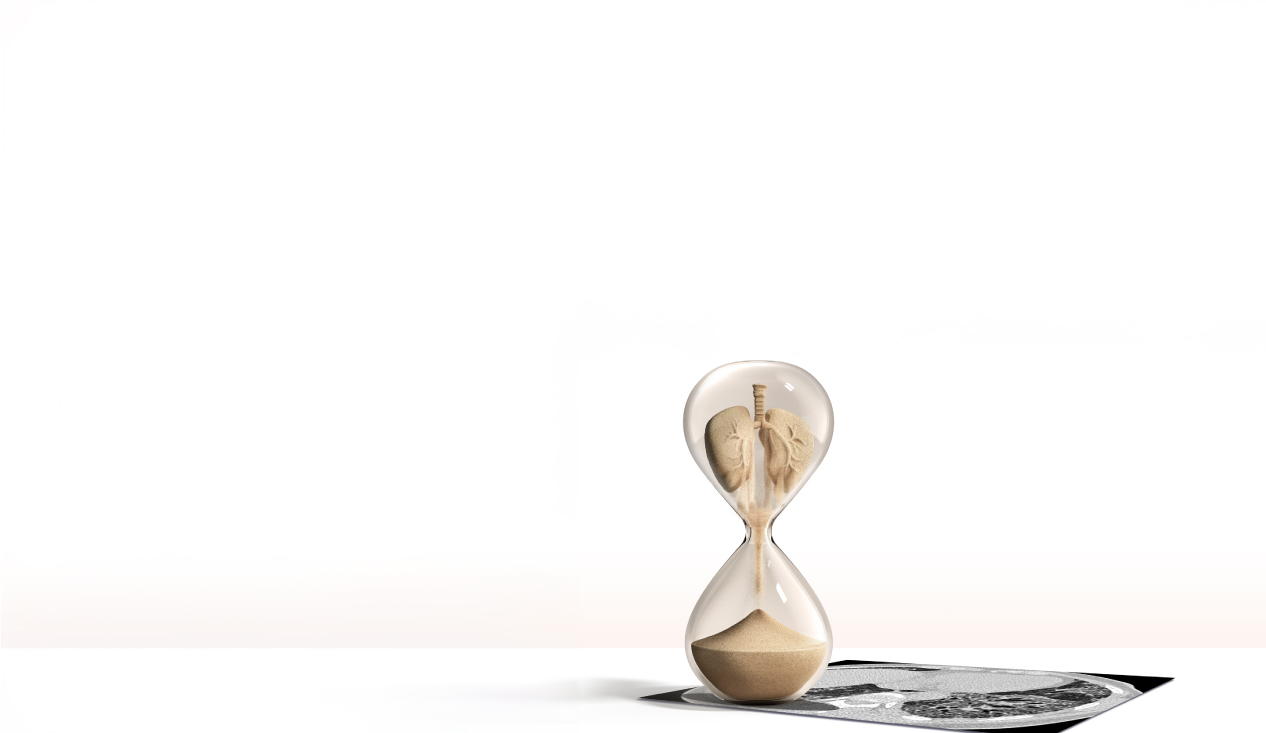 Suspeitou da Fibrose Pulmonar